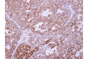 IHC-P Image TRAM1 antibody [C2C3], C-term detects TRAM1 protein at cytoplasm on AGS xenograft by immunohistochemical analysis. (TRAM1 抗体  (C-Term))