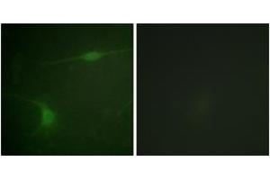 Immunofluorescence analysis of NIH-3T3 cells, using JIP1 (Phospho-Thr103) Antibody. (MAPK8IP1 抗体  (pThr103))