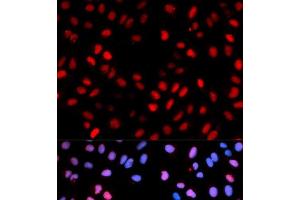 Immunofluorescence analysis of U2OS cells using Phospho-RAF1(S621) Polyclonal Antibody (RAF1 抗体  (pSer621))