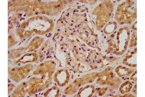 IHC image of ABIN7145800 diluted at 1:800 and staining in paraffin-embedded human kidney tissue performed on a Leica BondTM system. (BAZ2B 抗体  (AA 139-240))
