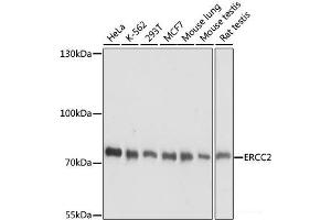 Western blot analysis of extracts of various cell lines using ERCC2 Polyclonal Antibody at dilution of 1:1000. (ERCC2 抗体)