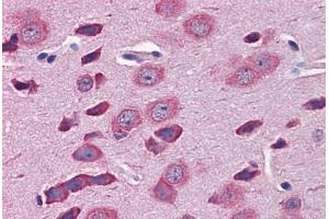Mouse Brain: Formalin-Fixed, Paraffin-Embedded (FFPE) (TBR1 抗体  (AA 51-100))