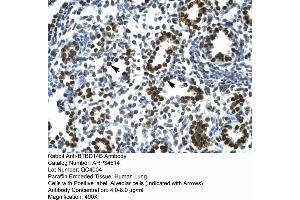 Immunohistochemistry (IHC) image for anti-Nucleus Accumbens Associated 1, BEN and BTB (POZ) Domain Containing (NACC1) (Middle Region) antibody (ABIN2775909)