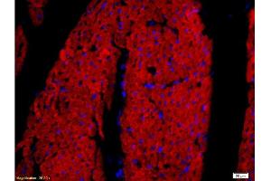 Formalin-fixed and paraffin embedded rat heart tissue labeled with Rabbit Anti-DOG-1/TMEM16A Polyclonal Antibody, Unconjugated at 1:200 followed by conjugation to the secondary antibody and DAB staining. (ANO1 抗体  (AA 151-250))