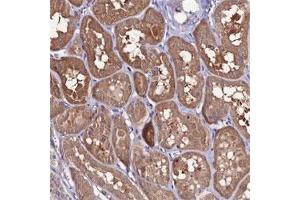 Immunohistochemical staining of human kidney shows moderate cytoplasmic positivity in tubular cells. (FZD8 抗体)