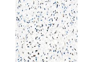 Immunohistochemistry (IHC) image for anti-SWI/SNF Related, Matrix Associated, Actin Dependent Regulator of Chromatin, Subfamily B, Member 1 (SMARCB1) antibody (ABIN7270657)