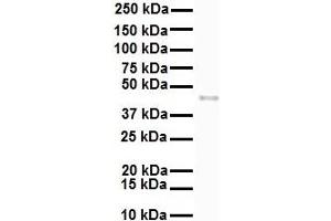 Western Blotting (WB) image for anti-Solute Carrier Family 27 (Fatty Acid Transporter), Member 2 (SLC27A2) (N-Term) antibody (ABIN2781594)