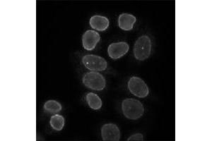Indirect immunofluorescence staining of HeLa cells with Lbr polyclonal antibody . (Lamin B Receptor 抗体)