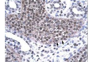 Image no. 1 for anti-TAF15 RNA Polymerase II, TATA Box Binding Protein (TBP)-Associated Factor, 68kDa (TAF15) (AA 42-91) antibody (ABIN6735812) (TAF15 抗体  (AA 42-91))