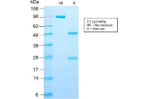 SDS-PAGE Analysis Purified Adipophilin Recombinant Rabbit Monoclonal Antibody (ADFP/2755R). (Recombinant ADRP 抗体  (AA 249-376))