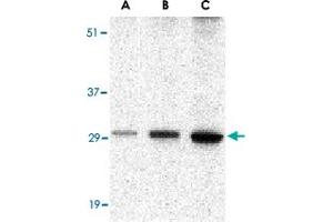 Western blot analysis of BCL2A1 in human kidney tissue lysate with BCL2A1 polyclonal antibody  at (A) 0. (BCL2A1 抗体  (C-Term))