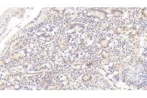 Detection of IL17 in Porcine Small intestine Tissue using Monoclonal Antibody to Interleukin 17 (IL17) (IL-17 抗体  (AA 25-153))