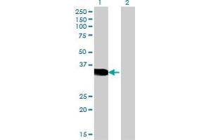 Western Blot analysis of CRX expression in transfected 293T cell line by CRX monoclonal antibody (M06), clone 4A12. (CRX 抗体  (AA 1-299))
