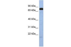 WB Suggested Anti-SIM1 Antibody Titration:  0. (SIM1 抗体  (N-Term))