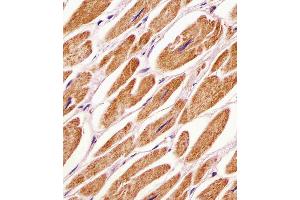 Antibody staining PDK4 in human heart tissue sections by Immunohistochemistry (IHC-P - paraformaldehyde-fixed, paraffin-embedded sections). (PDK4 抗体  (C-Term))