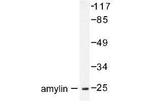 Image no. 1 for anti-Islet Amyloid Polypeptide (IAPP) antibody (ABIN271869) (Amylin/DAP 抗体)