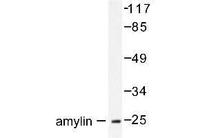 Image no. 1 for anti-Islet Amyloid Polypeptide (IAPP) antibody (ABIN271869) (Amylin/DAP 抗体)