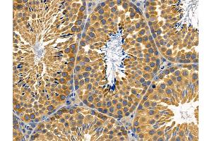 ABIN6259321 and ABIN6274774 at 1/100 staining Mouse testis tissue by IHC-P. (RPL26L 抗体  (C-Term))