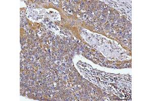 IHC analysis of HAX1 using anti-HAX1 antibody (ABIN7599208).