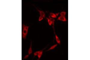 ABIN6267322 staining NIH-3T3 by IF/ICC. (EIF4E 抗体  (pSer209))