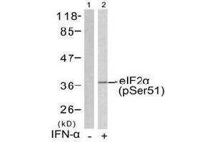 Image no. 1 for anti-Eukaryotic Translation Initiation Factor 2 Subunit 1 (EIF2S1) (pSer51) antibody (ABIN197047) (EIF2S1 抗体  (pSer51))