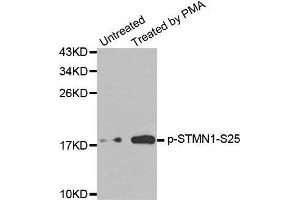 Western blot analysis of extracts from Jurkat cells, using Phospho-STMN1-S25 antibody. (Stathmin 1 抗体  (pSer25))
