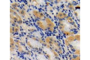 Used in DAB staining on fromalin fixed paraffin-embedded stomach tissue (SIRT3 抗体  (AA 126-399))
