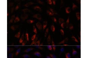 Immunofluorescence analysis of L929 cells using CHP1 Polyclonal Antibody at dilution of 1:100. (CHP 抗体)