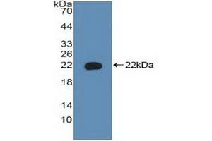 Detection of Recombinant BAD, Human using Polyclonal Antibody to Bcl2 Associated Death Promoter (BAD) (BAD 抗体  (AA 1-168))