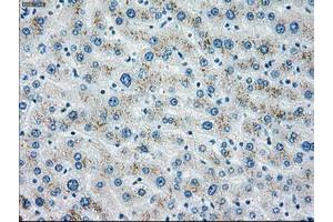 Image no. 2 for anti-Checkpoint Kinase 2 (CHEK2) antibody (ABIN1497500) (CHEK2 抗体)