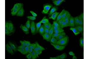 Immunofluorescence (IF) image for anti-Syntrophin, beta 1 (Dystrophin-Associated Protein A1, 59kDa, Basic Component 1) (SNTB1) (AA 51-111) antibody (ABIN7145359)