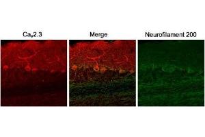 Immunohistochemistry (IHC) image for anti-Calcium Channel, Voltage-Dependent, R Type, alpha 1E Subunit (CACNA1E) (AA 892-907), (Intracellular) antibody (ABIN7043007)