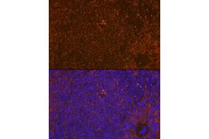 Immunofluorescence analysis of rat spleen using WASP Rabbit mAb (ABIN7271381) at dilution of 1:100 (40x lens). (WASP 抗体)