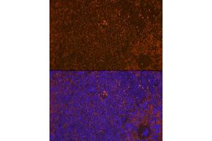 Immunofluorescence analysis of rat spleen using WASP Rabbit mAb (ABIN7271381) at dilution of 1:100 (40x lens). (WASP 抗体)
