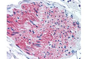 Anti-P2RX7 / P2X7 antibody IHC of human pancreas, nerve. (P2RX7 抗体  (Internal Region))