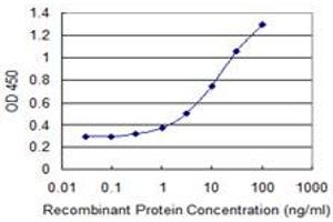 Detection limit for recombinant GST tagged RBM15 is 0. (RBM15 抗体  (AA 701-810))