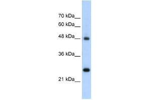 Chromogranin A antibody used at 5 ug/ml to detect target protein. (Chromogranin A 抗体)