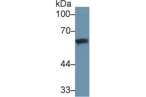 Detection of DBP in Human Lung lysate using Monoclonal Antibody to Vitamin D Binding Protein (DBP) (Vitamin D-Binding Protein 抗体  (AA 209-401))