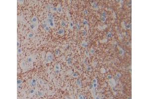 Used in DAB staining on fromalin fixed paraffin- embedded brain tissue (Cnpase 抗体  (AA 186-421))