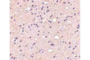 Immunohistochemistry of ELOVL6 in human brain with ELOVL6 antibody at 5 μg/ml. (ELOVL6 抗体  (N-Term))