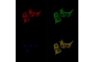 ABIN7093102 and ABIN7097256 staining Hela cells(heat shock treatment) by IF/ICC. (MLKL 抗体  (pSer352))