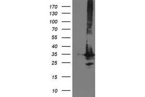 Image no. 1 for anti-Phenylethanolamine N-Methyltransferase (PNMT) antibody (ABIN1500306) (PNMT 抗体)