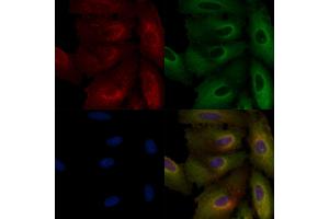 ABIN6265394 and ABIN6266638 staining  cells by IF/ICC. (Synaptophysin 抗体  (Internal Region))