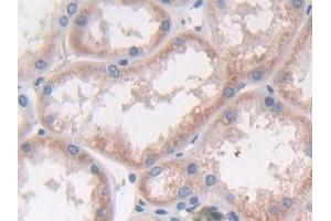 Detection of IFNa2 in Human Kidney Tissue using Polyclonal Antibody to Interferon Alpha 2 (IFNa2) (IFNA2 抗体  (AA 24-188))