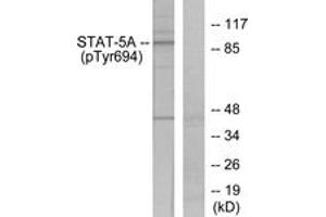 Western Blotting (WB) image for anti-STAT5 A/B (STAT5 A/B) (pTyr694) antibody (ABIN2888534) (STAT5 A/B 抗体  (pTyr694))