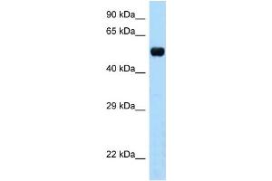 WB Suggested Anti-Tapbpl Antibody Titration: 1.