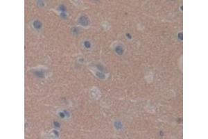 Immunohistochemistry (IHC) image for anti-Peptidyl Arginine Deiminase, Type II (PADI2) (AA 1-300) antibody (ABIN1869655)