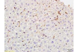 Formalin-fixed and paraffin embedded rat liver tissue labeled with Rabbit Anti-phospho-CD32B(Tyr292) Polyclonal Antibody at 1:200 followed by conjugation to the secondary antibody and DAB staining. (FCGR2B 抗体  (pTyr292))