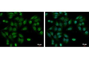 ICC/IF Image UBE2A antibody detects UBE2A protein at cytoplasm and nucleus by immunofluorescent analysis. (UBE2A 抗体)