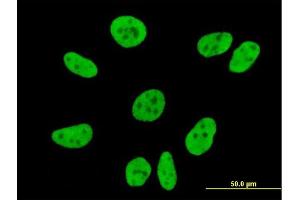 Immunofluorescence of monoclonal antibody to FLJ20097 on HeLa cell. (Syndetin/VPS50 抗体  (AA 862-964))